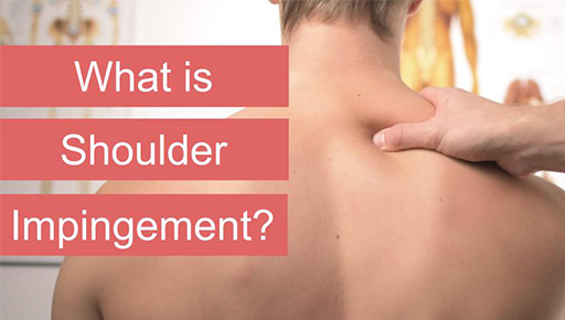 Shoulder Impingement