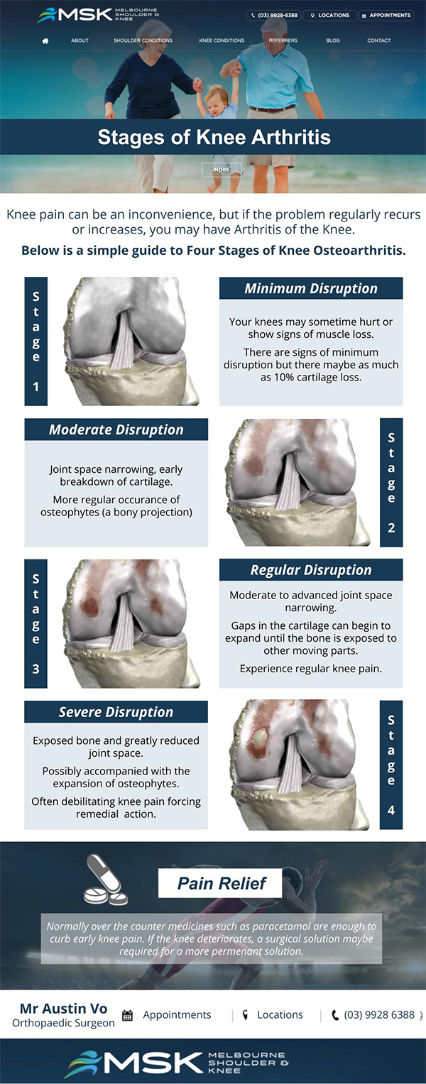 Stages of Knee Arthritis