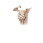 Latarjet