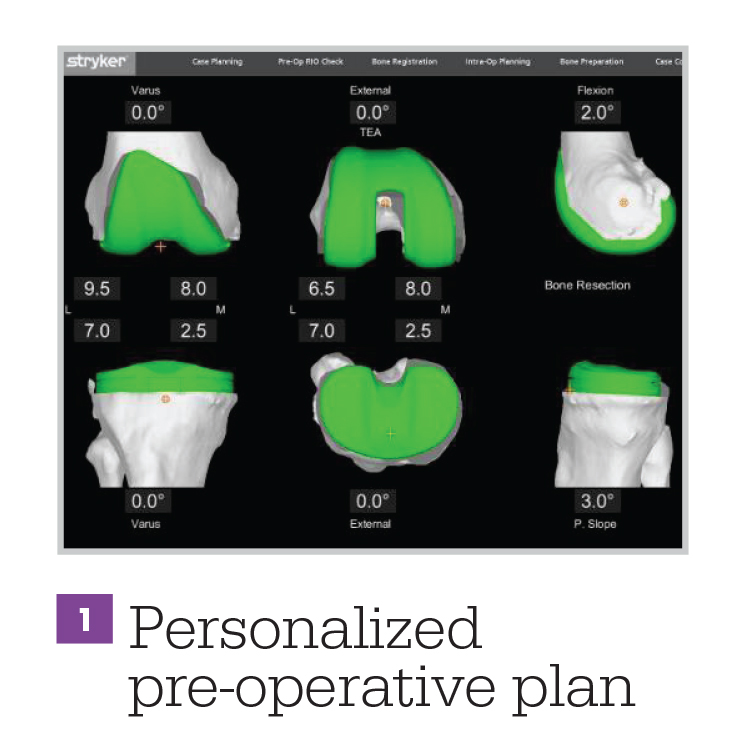 personalized-pre-operative