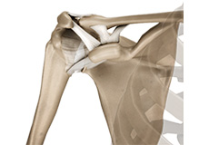 AC Joint Arthritis