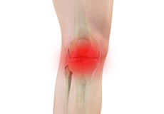 Knee Pain