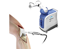 Robotic Assisted Partial Knee Replacement